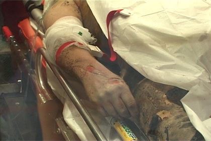 S-a electrocutat in timp ce incerca sa fure componente neferoase