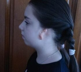O fetiță de 8 ani, născută cu dublă atrezie și microtie, are nevoie de ajutor