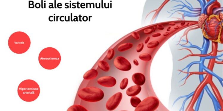Harta deceselor cauzate de tensiune și alte boli ale sistemului circulator
