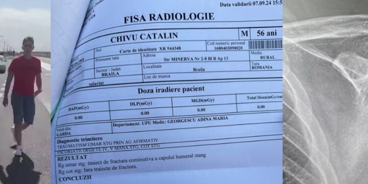 Jurnalistul Cătălin Chivu s-a ales cu traiect de fractură cominutivă a capului humeral stâng după ce a fost împins de fermierul PSD-ist Nicu Ardeleanu
