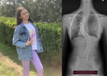 Ajut-o pe Ilaria să-și recapete copilăria!