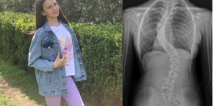 Ajut-o pe Ilaria să-și recapete copilăria!